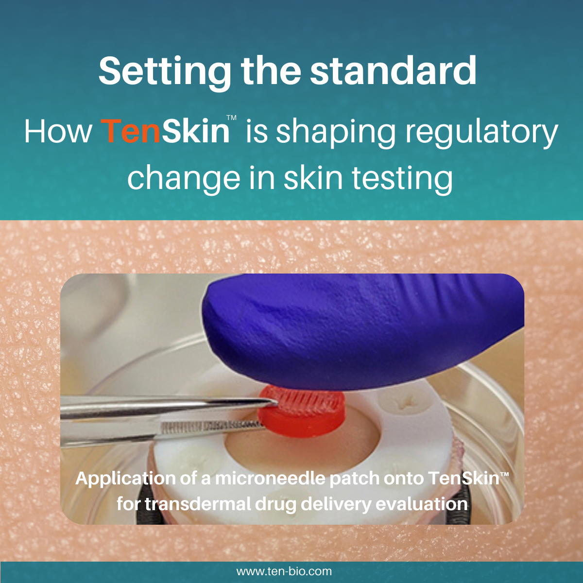 Setting the standard: How TenSkin is shaping regulatory change in skin ...